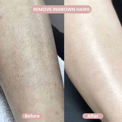 GlowTrim™ – 2-in-1 Bikini Trimmer