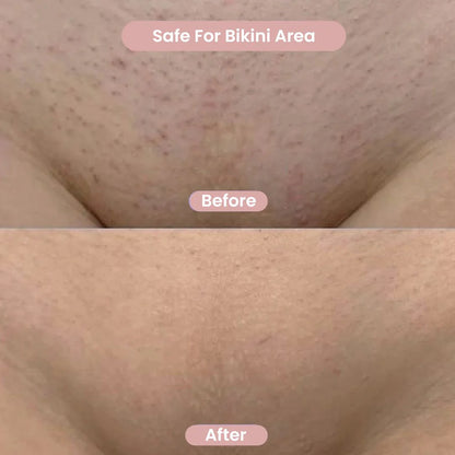 GlowTrim™ – 2-in-1 Bikini Trimmer